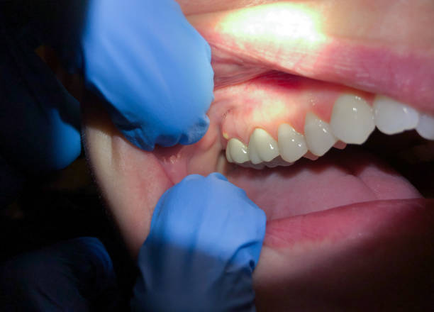 Best Emergency Cosmetic Dentistry (e.g., broken veneers) in Ridgefield Park, NJ