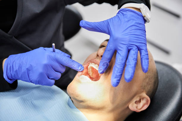 Best Emergency Root Canal Therapy in Ridgefield Park, NJ